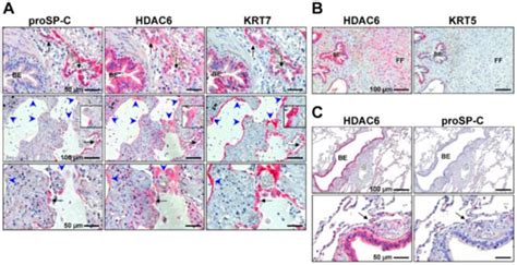 Cells | Special Issue : State of the Art in Idiopathic Pulmonary Fibrosis