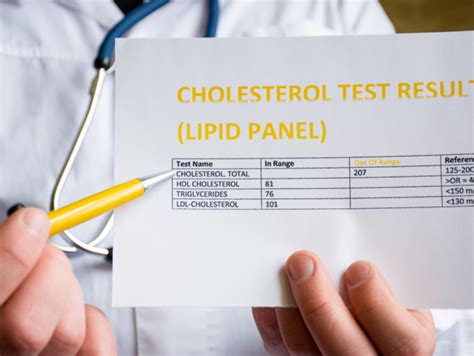 10 reasons why your cholesterol doesn't reduce (habits that keep ...