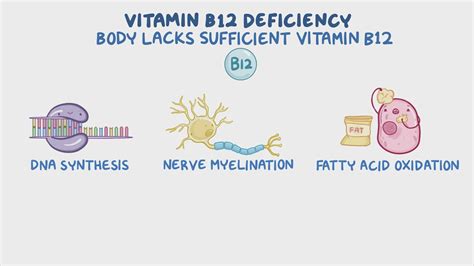 Vitamin B12 Deficiency Cks at Caleb Aitken blog