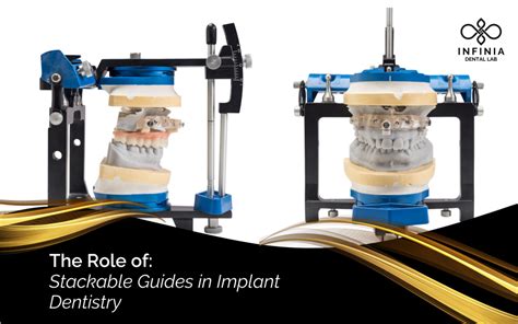 Image result for Stackable Guide Dailymotion