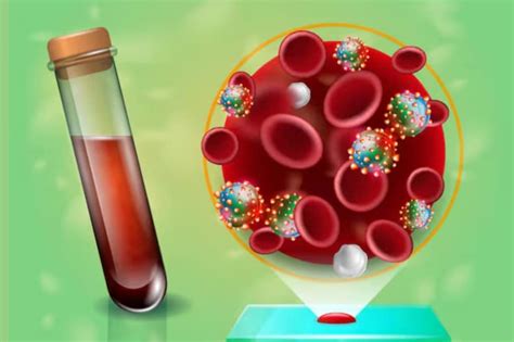 Blood Group: మీ బ్లడ్‌ గ్రూప్ ఇదేనా?.. అయితే మతిమరుపు వచ్చే రిస్క్ ...