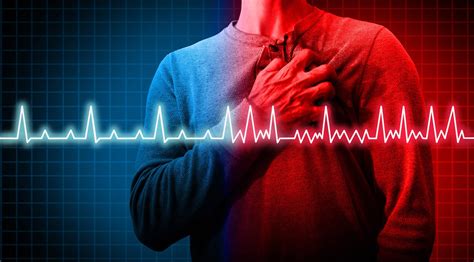 AFib Heart Condition 的图像结果