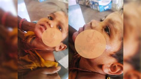 Gwalior: खूंखार सियार ने 3 बच्चों सहित एक महिला पर किया हमला, नोंचे ...