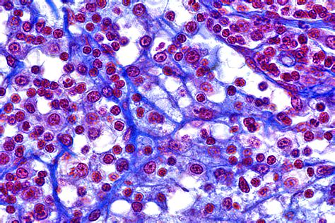 Reticular Formation Nuclei