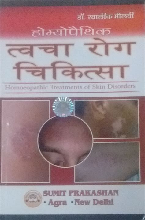 Homoeopathic Tvacha Rog Chikitsa (Homoeopathic Treatments of Skin ...