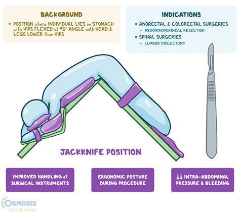 Jackknife Position: What Is It, Uses, and More | Osmosis
