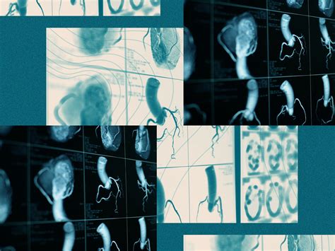 Are Hives Contagious? What You Need to Know About Urticaria