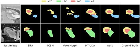 Segmentation Visualization Stack Overflow 的图像结果