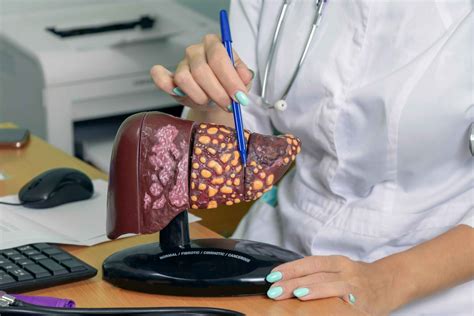 Liver Cancer Survival Rates and Prognosis - Apollo Proton