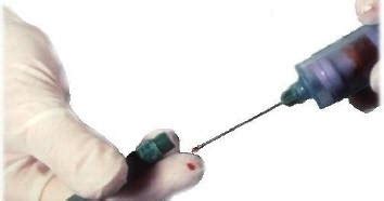 Image result for Recapping of Needlre