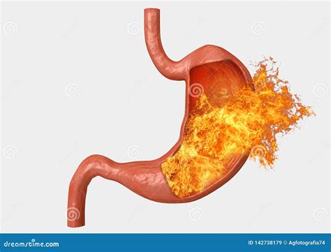 Burning Pain In Stomach