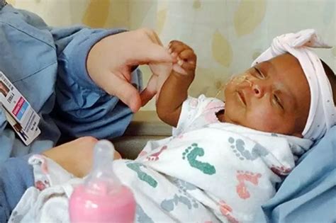 Tiny But Mighty: World's Smallest Baby Ever, Weighing Just 245 Grams ...