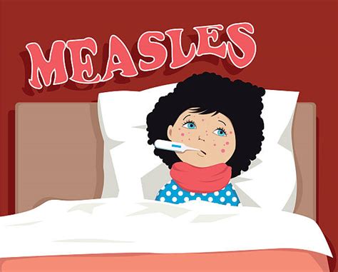 Royalty Free Measles Clip Art, Vector Images & Illustrations - iStock