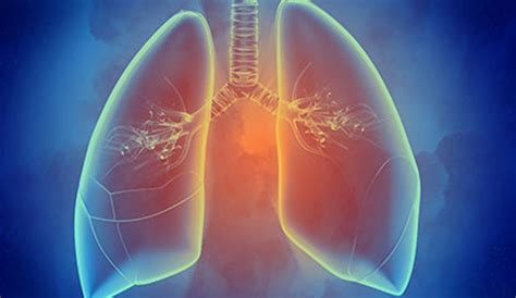 Copd Chronic Obstructive Pulmonary Disease symptoms causes treatment in ...