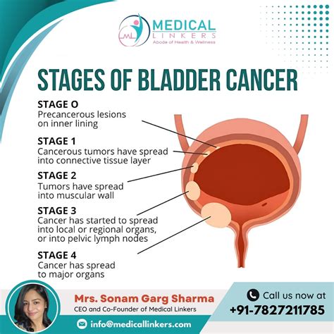 Bladder Cancer Staging
