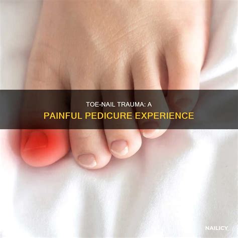 Toe-Nail Trauma: A Painful Pedicure Experience | Nailicy