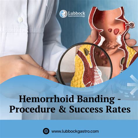 Hemorrhoid Banding Lubbock, TX- Procedure & Success Rates