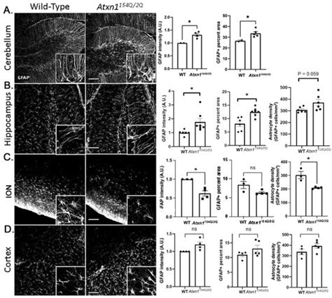 Spatial and Temporal Diversity of Astrocyte Phenotypes in ...