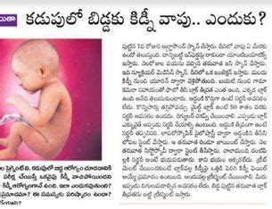 Dr. Lavanya Kannaiyan - Best Pediatric Surgeon in Hyderabad | Rainbow ...