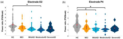 Brain Dynamics Altered by Photic Stimulation in Patients with Alzheimer ...