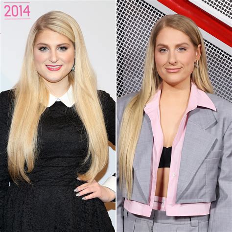 Meghan Trainor Reveals Plastic Surgery Plans: Photos of the Singer’s Transformation Through the ...