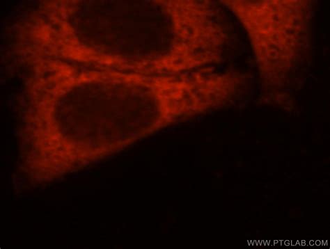 DNAJC5B antibody (17364-1-AP) | Proteintech