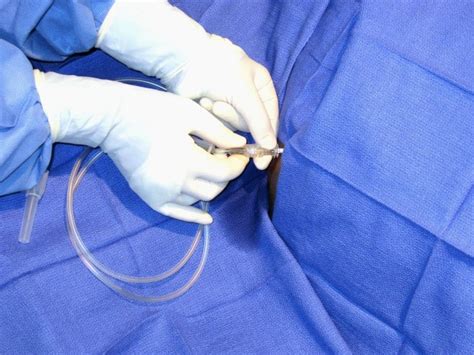 Image result for Paracentesis Procedure Kit