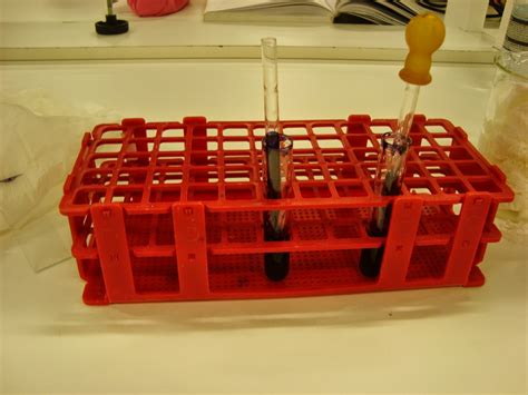 CUADERNO DE PRÁCTICAS HEMATOLOGÍA: Práctica: Detección de cuerpos de Heinz.