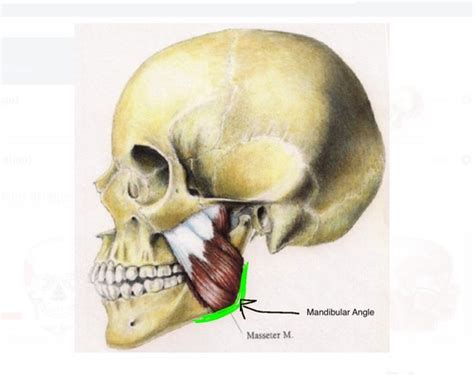 Image result for Masseter Muscle Trigger Point