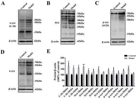 Gastric Enteric Glial Cells: A New Contributor to the Synucleinopathies ...
