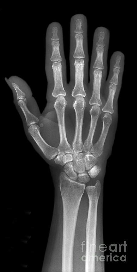 Image result for Normal Hand