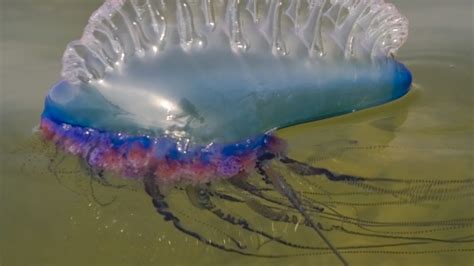 Giant Man O War Jellyfish Stings
