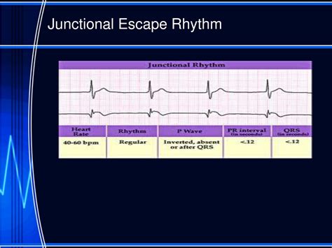 PPT - Nursing Interpretation of the Electrocardiogram (ECG), Telemetry PowerPoint Presentation ...