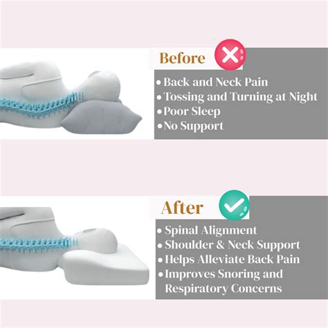 Cervical Spondylosis Pillow India I JSB BS52 Online