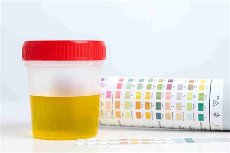 Can Early Pregnancy Affect Urine Colour and Smell?