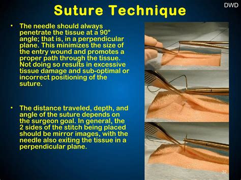 Image result for Suturing Tutorial
