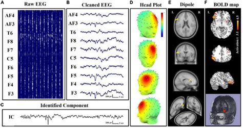 Frontiers | Simultaneous electroencephalography-functional magnetic ...