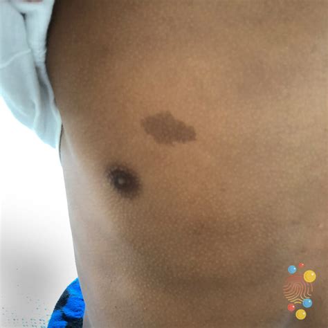 Welcome to Skin Deep - Skin Deep