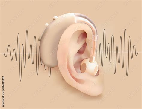 Hearing aid behind ear. Ear and sound amplifier on background of sound wave pattern. Deafness ...