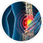 Cupping Therapy Center Delhi, NCR | Doctors for Cupping therapy | APRC