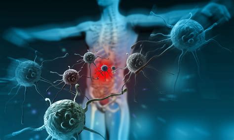 One Dead, Six Hospitalised After Legionnaires’ Disease Surge at Sydney ...