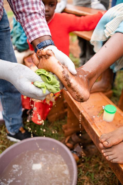 Jigger Fleas Remove 的图像结果