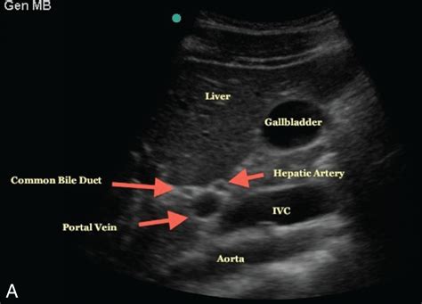 Vascular System - Clinical Tree