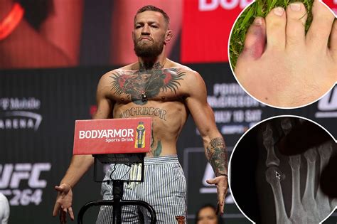 Conor McGregor opens up about UFC injury at Bellator Dublin event