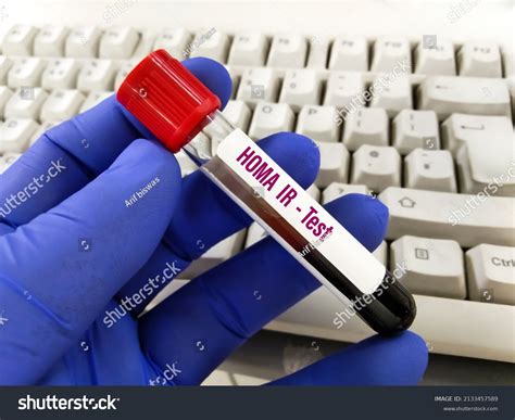 Homa Ir Test Photos and Images | Shutterstock