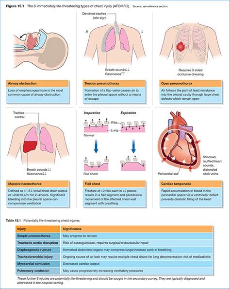 types of chest injury Android IOS V- 2.12