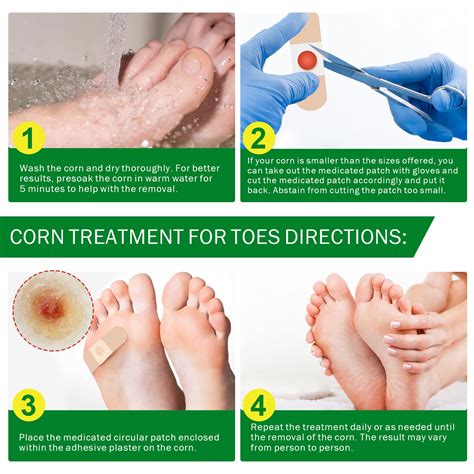 Corn Foot Removal