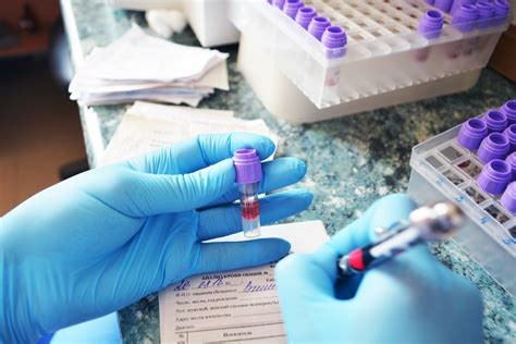 CMP Blood Test Explained - Precision Labs