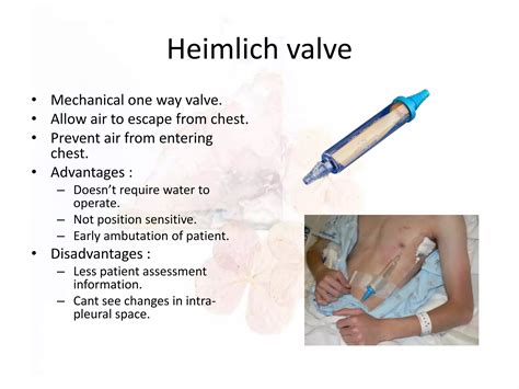 Chest tube insertion ppt (surgery) | PPTX