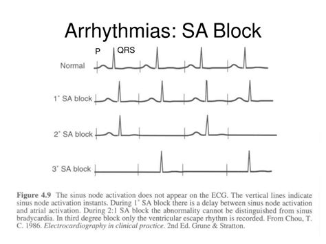 Image result for ACLS Post Cardiac Algorithm